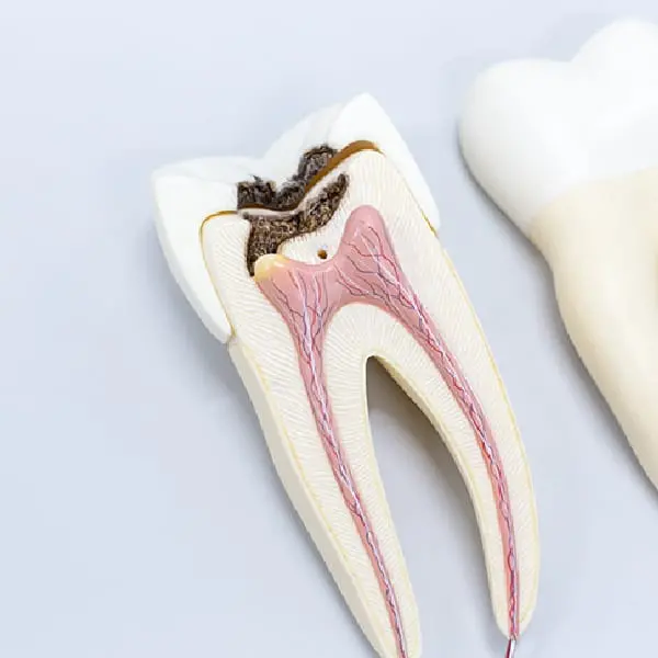 イメージ:一般歯科