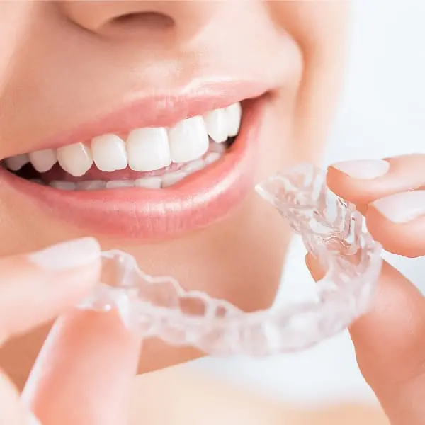 イメージ:マウスピース矯正