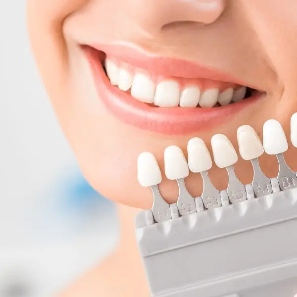 イメージ:ホワイトニング